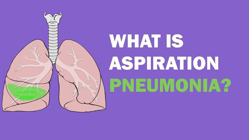 Aspire Etmek Nedir? Aspirasyon Nasıl Uygulanır ? Aspirasyon Ekipmanları Nelerdir ?