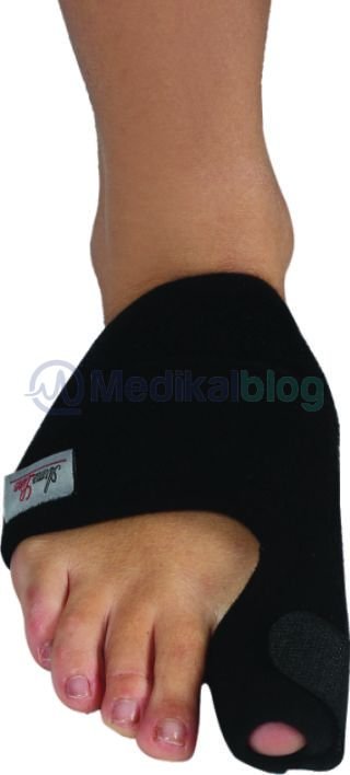 Hallux Valgus Gece Ateli (Ayak Baş Parmak Kemik Düzeltici)