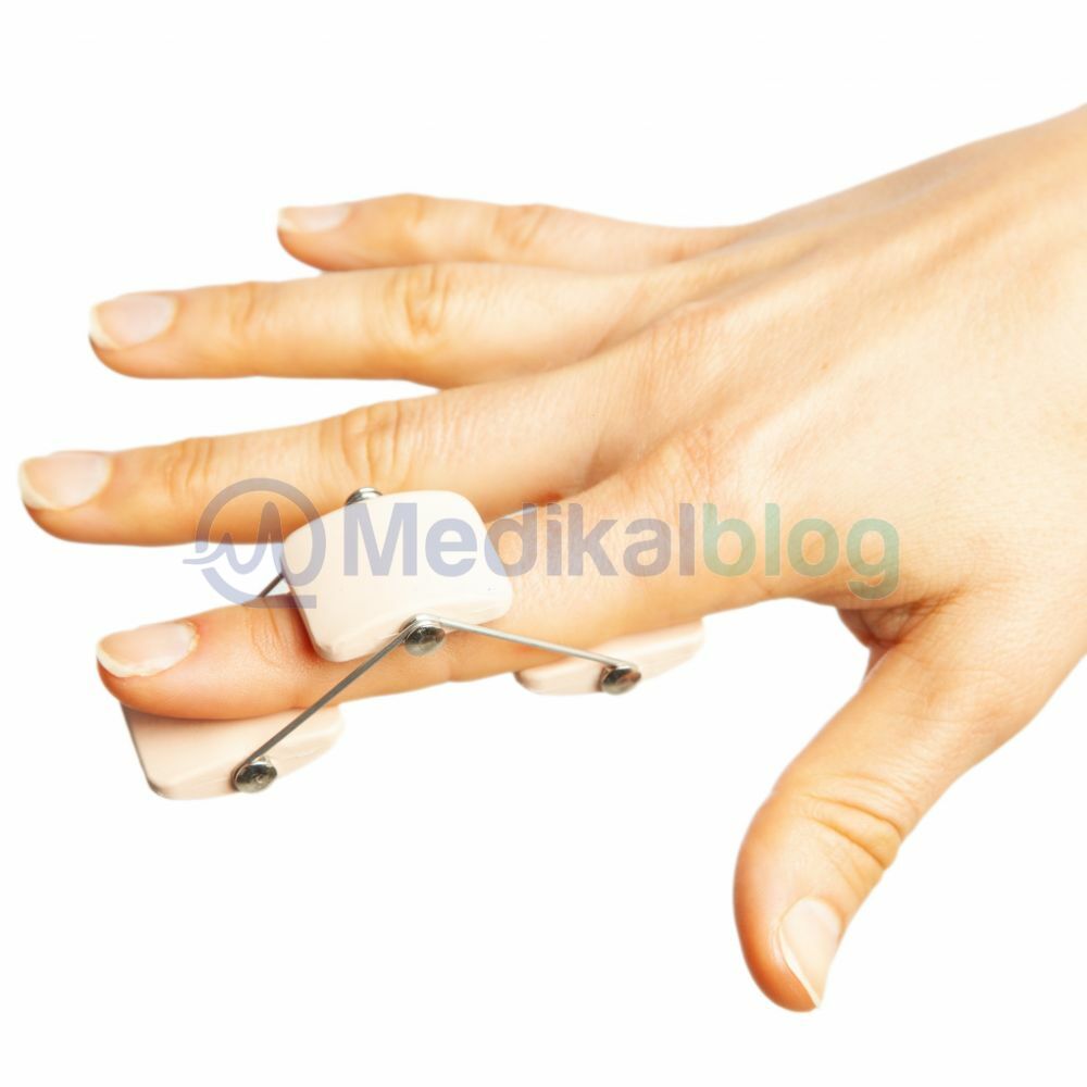 ATEL Butonier Yaylı Parmak Sabitleme Ateli